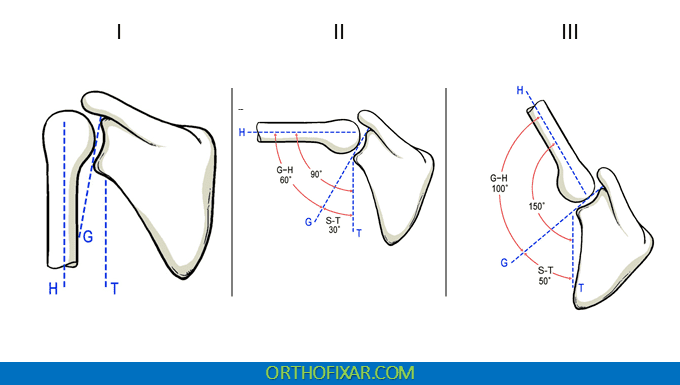 Diagram of scapulohumeral rhythm phases
